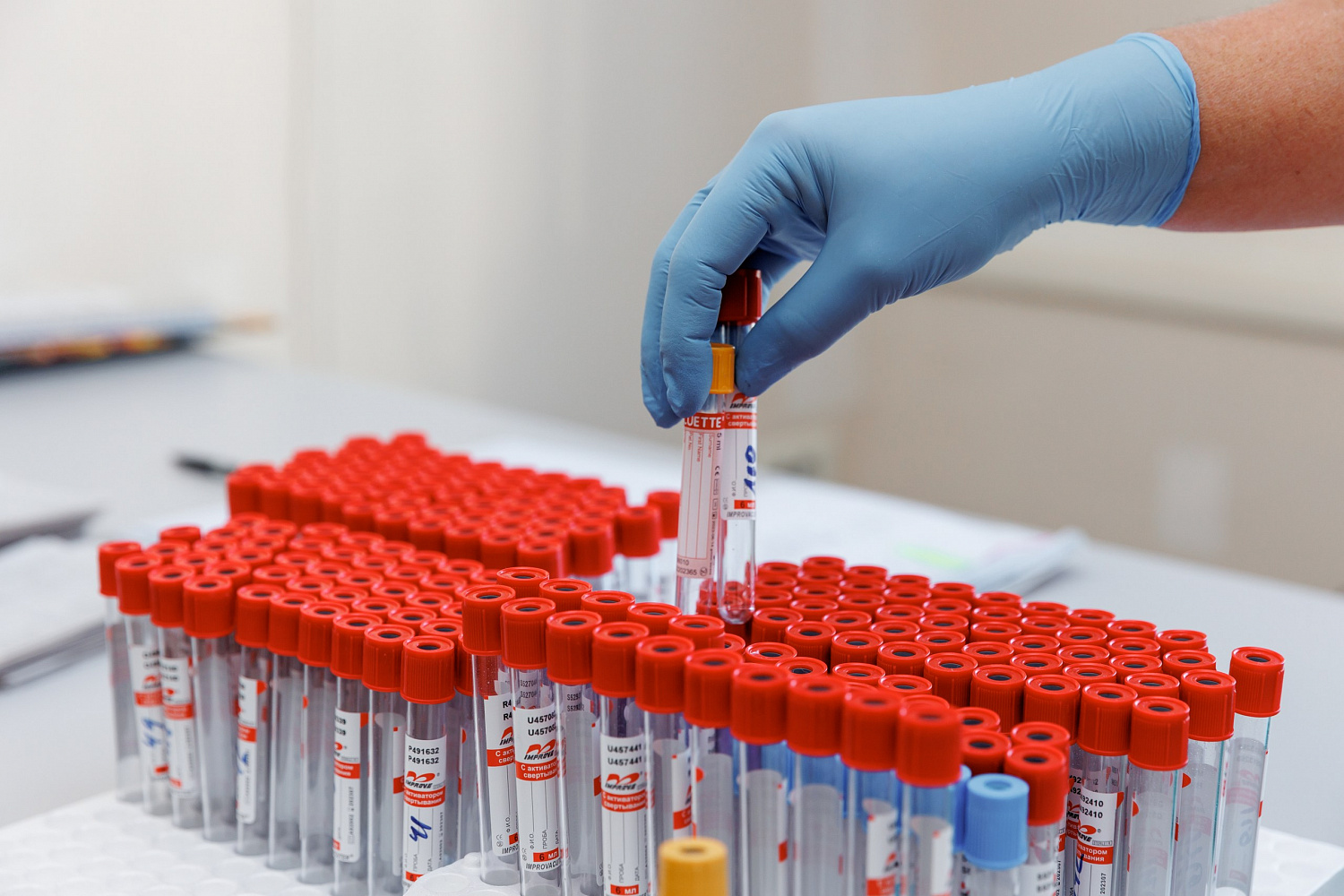 Анализы на сифилис, ВИЧ, гепатиты